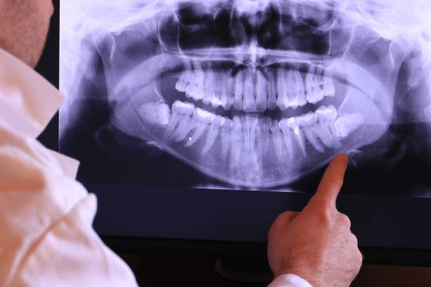 Best Emergency Root Canal Treatment in Gosnell, AR